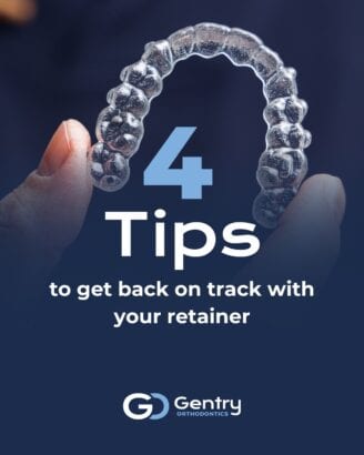4 tips on retainers